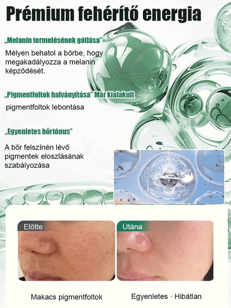 Egyetlen permet elegendő! 🌟 Hatoljon a bőr mélyére és könnyedén szabaduljon meg a makacs pigmentfoltaktól! 💥