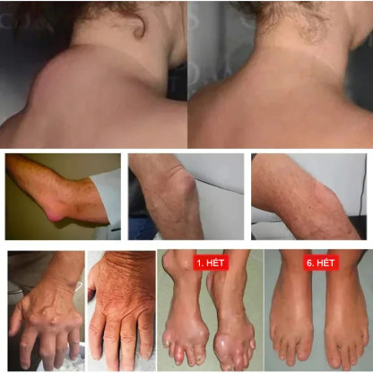 Kígyócsont öt méreg aranycsont olaj