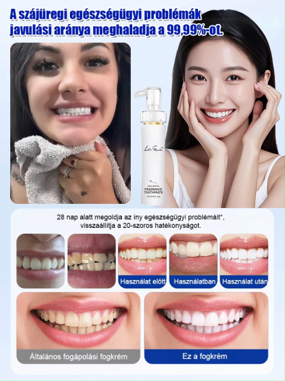 Ne hagyd, hogy a fogfolt elrontsa a mosolyodat!