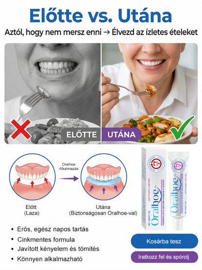 ✨ÉlelmiszeripariHőre Lágyuló Fogsor Rögzítő - 5 perc a stabil fogsorért