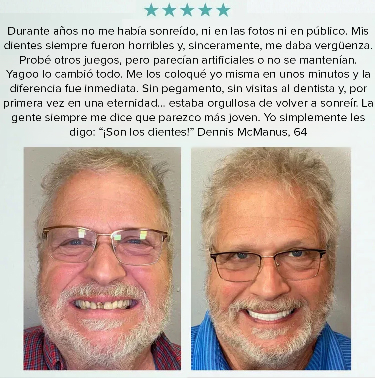 Save up to 90% on dental bills ✨ Custom-fitted mold ensures perfect comfort ❤️