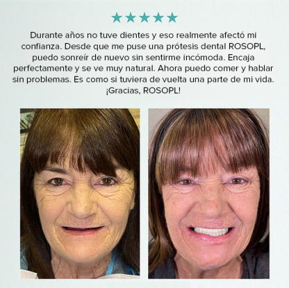 Save up to 90% on dental bills ✨ Custom-fitted mold ensures perfect comfort ❤️