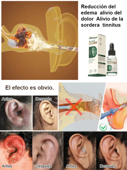 Gentle plant-based formula that soothes ear discomfort and maintains hygiene🌿