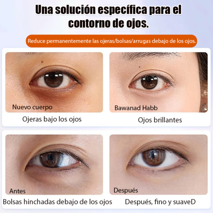 🚀 Smooth away crow's feet, firming eye essence oil ✨Restore the plump gaze of youth