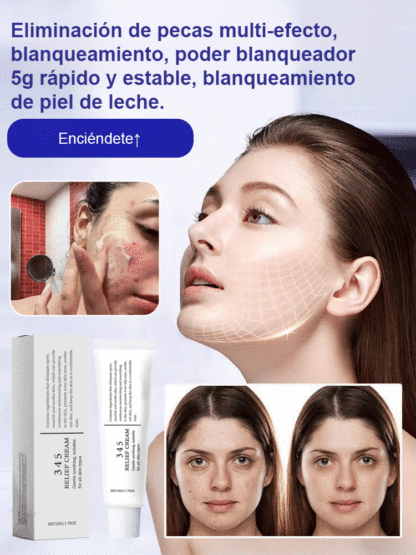 ✨ Fade dark spots, acne marks, and sun spots in 7 days! Medical-grade spot-removing cream from Germany