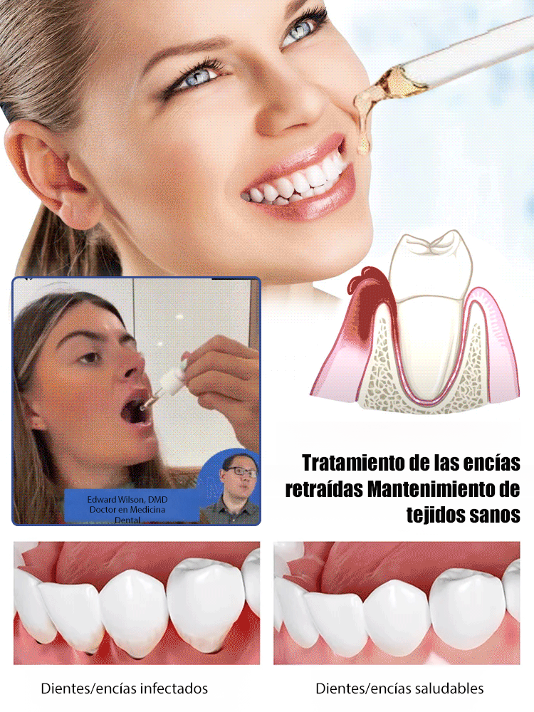 💰Say goodbye to expensive dental treatments! Tooth regeneration drops💎deep filling for cavities