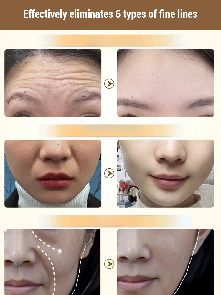 [One spray to remove wrinkles] 3 seconds to reduce wrinkles Lingzhi polypeptide anti-wrinkle spray
