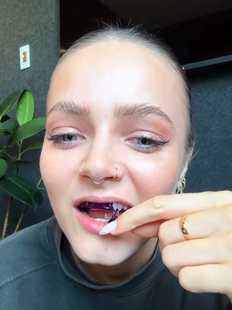 Yellow teeth to BLINDING white! ✨ Watch the 10-minute transformation!  The #1 dentist-recommended DIY whitening. Professional brilliance with zero sensitivity.