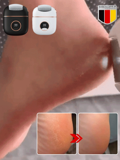 Transform your feet in just one minute. Equipped with a German-made TurboCare smart sensor that accurately identifies your skin condition.