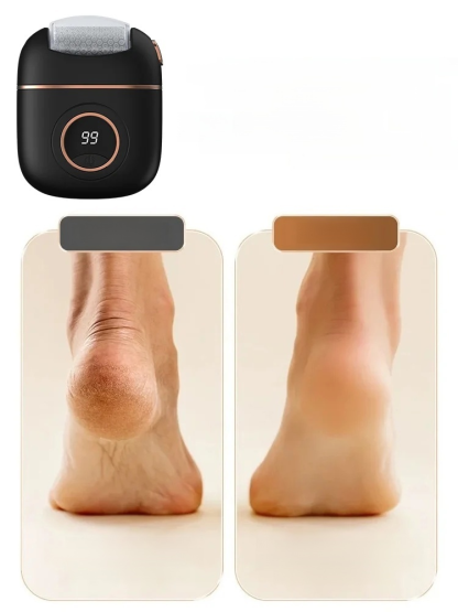 Transform your feet in just one minute. Equipped with a German-made TurboCare smart sensor that accurately identifies your skin condition.