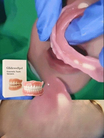  [Epic Upgrade] Premium Full Cover Dentures, Latest 3rd-gen silicone dentures: No grinding, 1min fit, natural. Pay after delivery if satisfied.