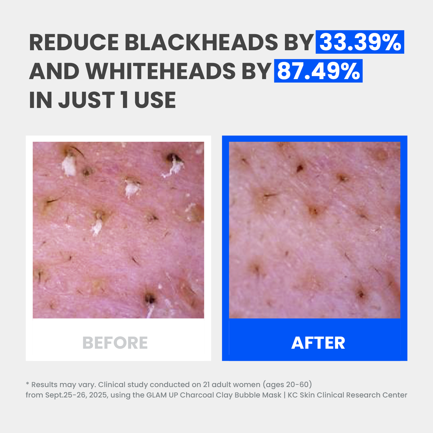 GLAM UP Clean Bubbling Carbonated Clay Mask for Face Purifying 135ml (4.56 Fl Oz)