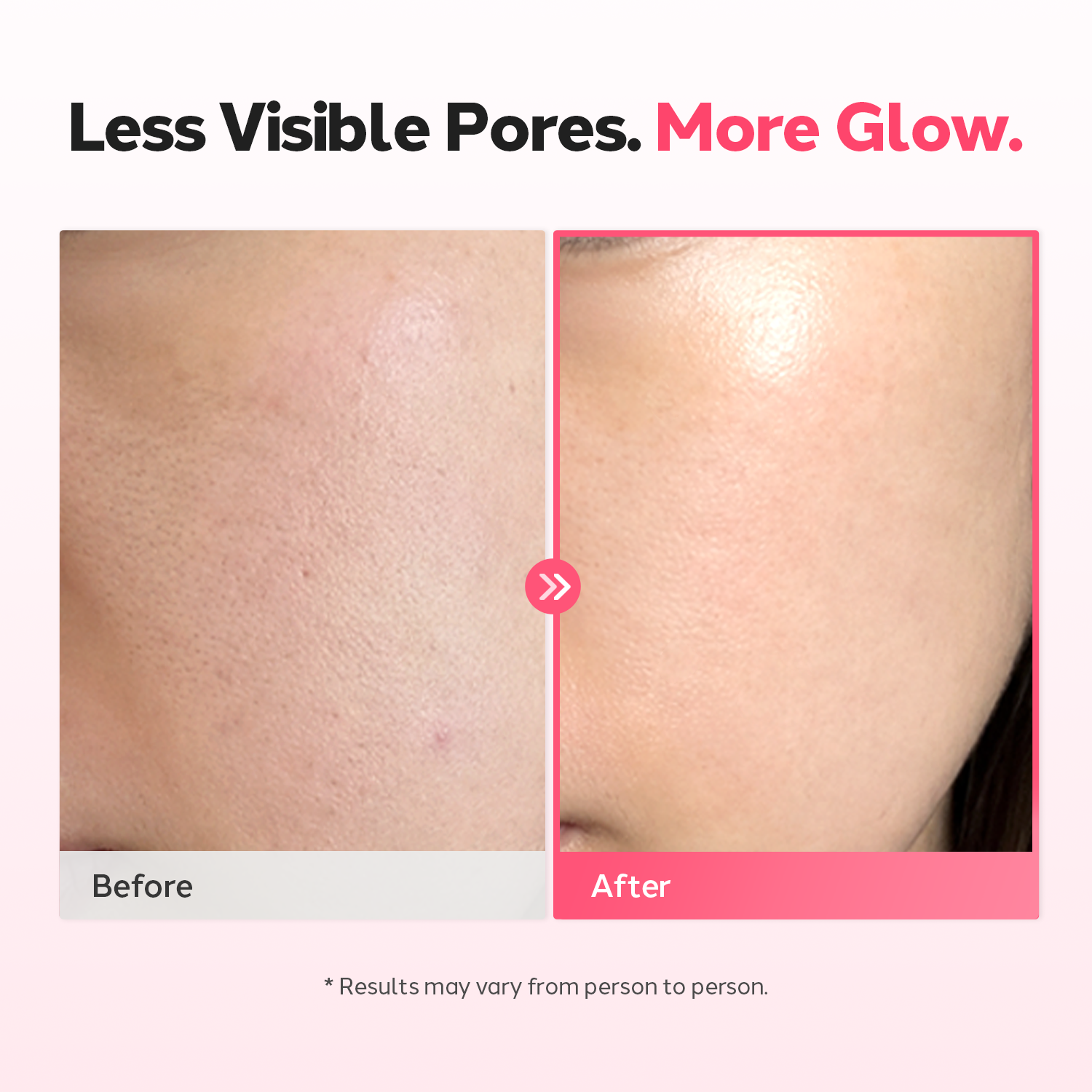 VitaSnow PDRN 20,000ppm Toning Serum