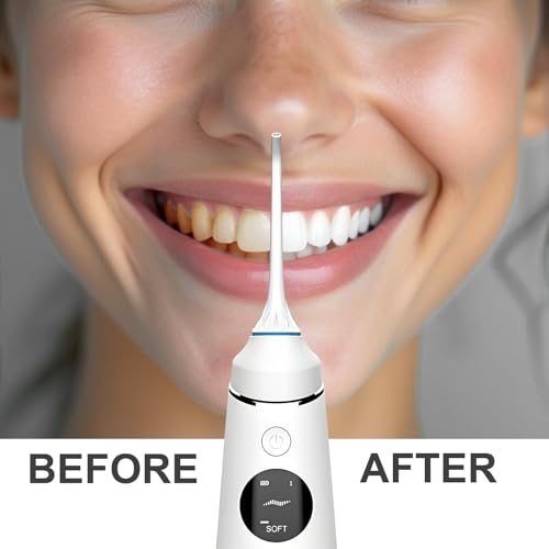 2660 Nicefeel LCD Display Water Flosser Cleaner-White