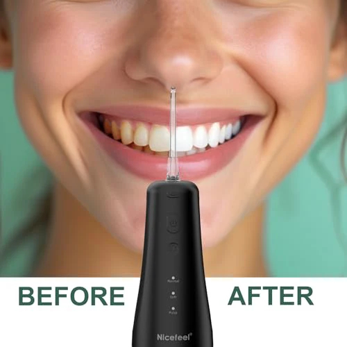 5091 Nicefeel LCD Display Water Flosser Cleaner-Black