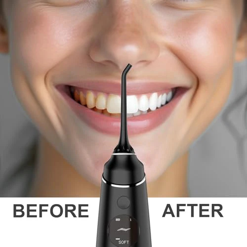 2660 Nicefeel LCD Display Water Flosser Cleaner-Black