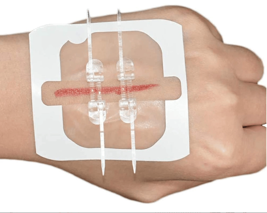Laceration suturing kit, bandages, zipper butterfly bandages, wound care and first aid patches.