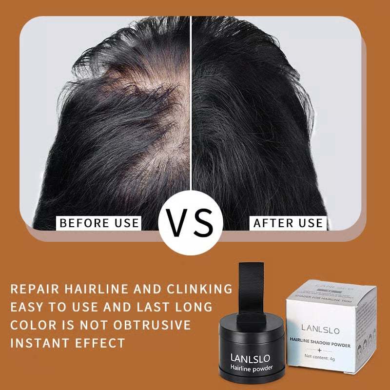 🔥Hairline Powder - Instant Coverage for Thinning or Balding Areas