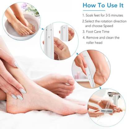 🌸Last Day 57% OFF🌸Electric Feet Callus Remover – Unisex Design!