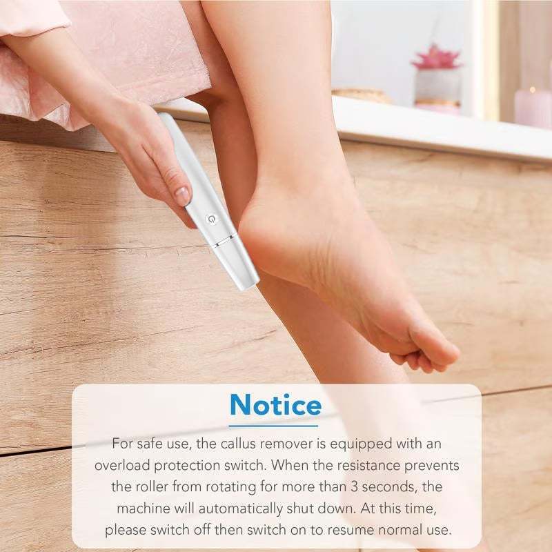 🌸Last Day 57% OFF🌸Electric Feet Callus Remover – Unisex Design!
