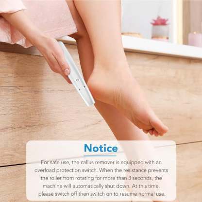 🌸Last Day 57% OFF🌸Electric Feet Callus Remover – Unisex Design!