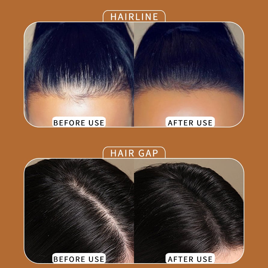 🔥Hairline Powder - Instant Coverage for Thinning or Balding Areas