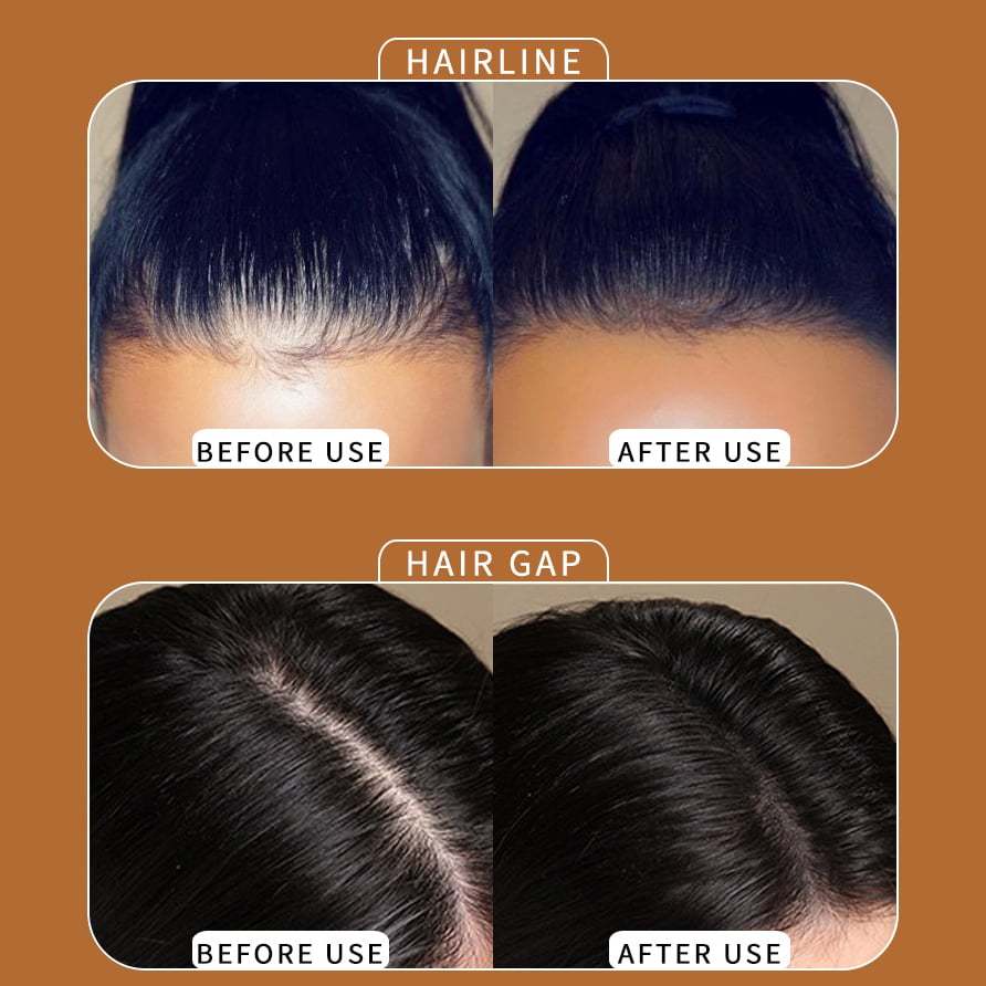 🔥Hairline Powder - Instant Coverage for Thinning or Balding Areas