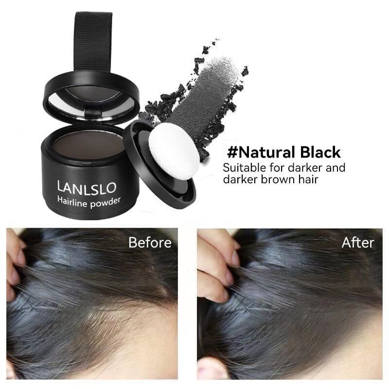 🔥Hairline Powder - Instant Coverage for Thinning or Balding Areas