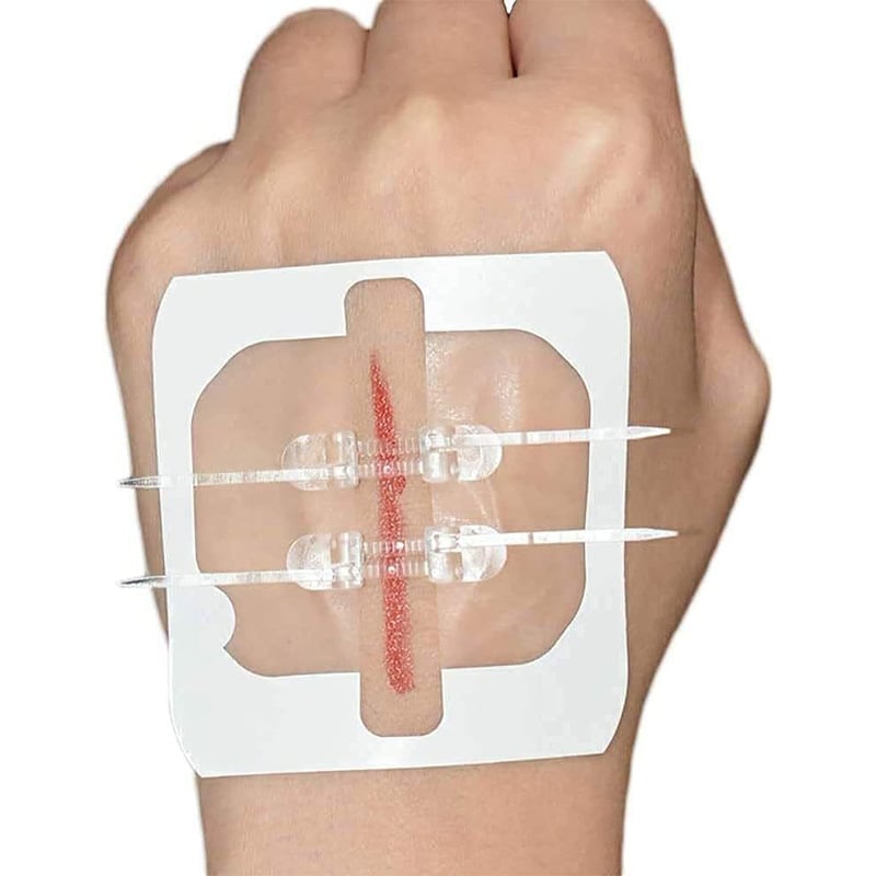 Laceration suturing kit, bandages, zipper butterfly bandages, wound care and first aid patches.