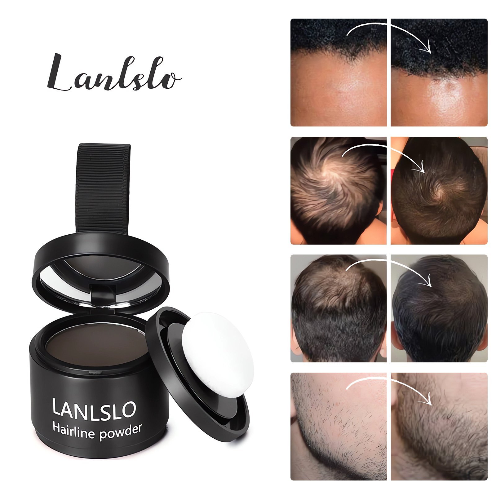🔥Hairline Powder - Instant Coverage for Thinning or Balding Areas