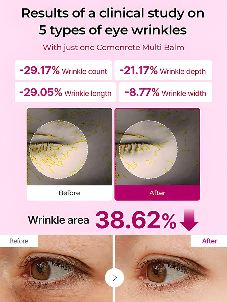 This micro-calcium filler cream uses advanced bioactive technology to strengthen the skin's natural barrier, plumping up deep wrinkles from the inside out.