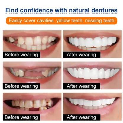 Whitening artificial teeth dentures✨ Invisible Wear – Confident Smile in 1 Second🦷 Realistic Dental Material – Whitening & Restoration in One