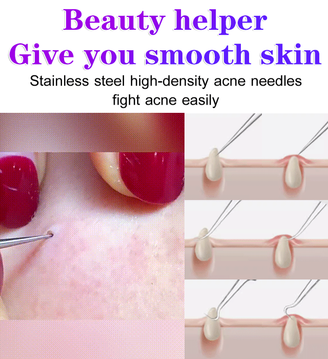 Zero-Blemish Aesthetics ✨High precision and high hardness cell clamp💎🧖‍♀️ Reshaping Pure Skin Texture