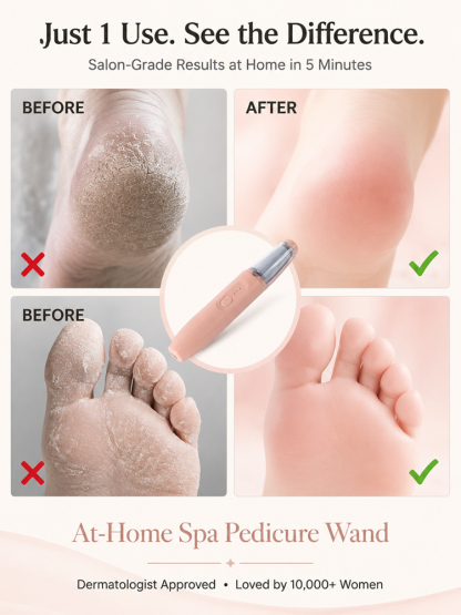 No More Cracked Heels: Get Baby-Soft Feet in Just 60 Seconds 🦶✨Rock Your Sandals with Confidence: Professional Pedi at Home 👡💃