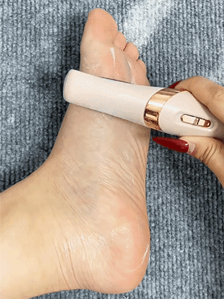 No More Cracked Heels: Get Baby-Soft Feet in Just 60 Seconds 🦶✨Rock Your Sandals with Confidence: Professional Pedi at Home 👡💃