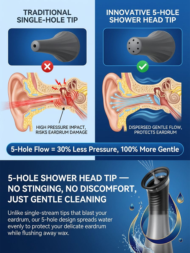 Premium 5-Hole Sonic Ear Wax Remover [Made in USA Designed / CE Certified] – Safe 30-Second Ear Irrigation System. STOP Using Dangerous Cotton Swabs Now!