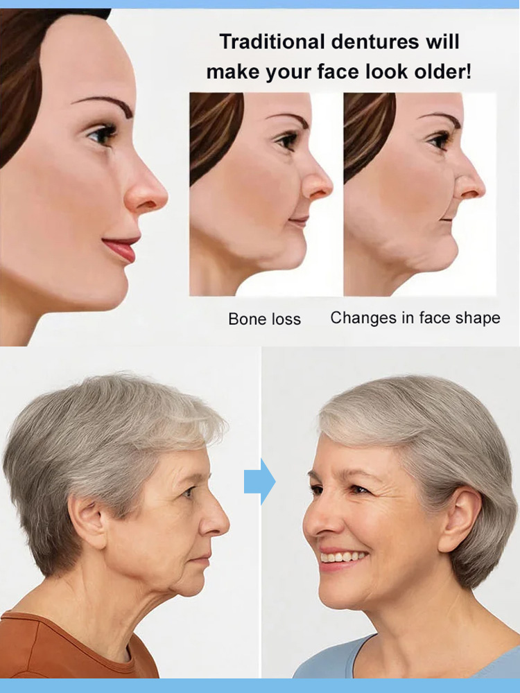 Denture modification kit