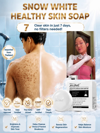 SL-Niacinamide Skin Renewal and Whitening Soap, Say goodbye to dark spots and hello to radiant skin!