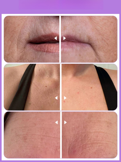 [ Anti-Wrinkle Calcium Balm]✨ Smooth Out Fine Lines Instantly — Replenish Lost Calcium & Boost Collagen for Firmer Skin!