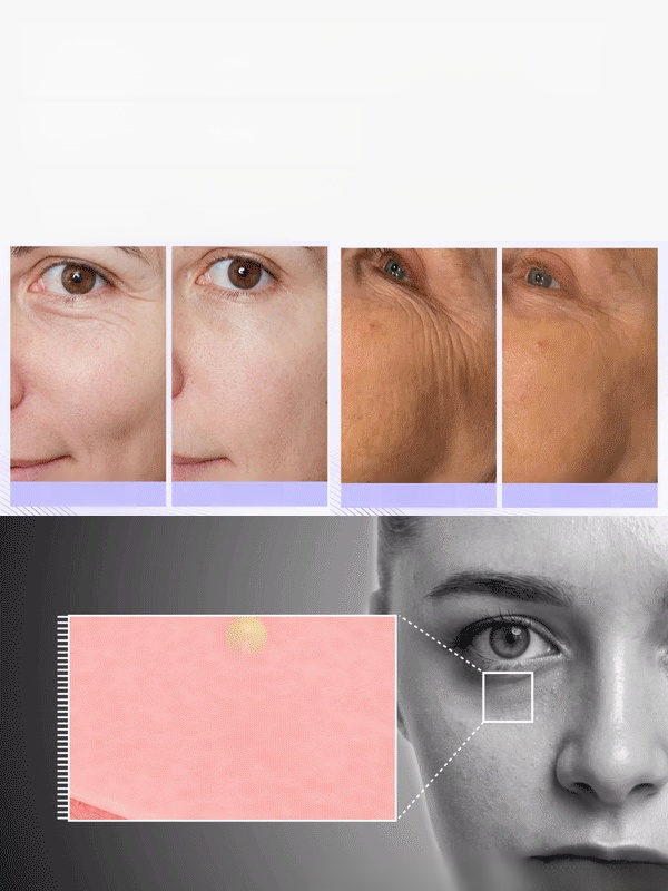 [ Anti-Wrinkle Calcium Balm]✨ Smooth Out Fine Lines Instantly — Replenish Lost Calcium & Boost Collagen for Firmer Skin!