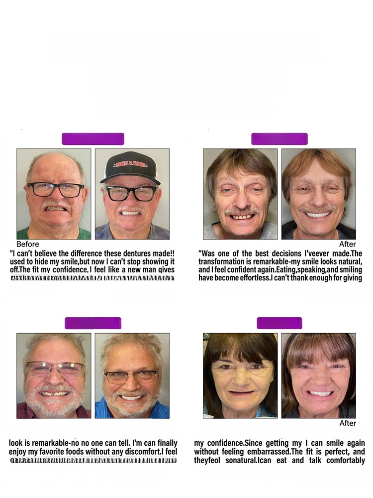 [Professional Certification] Regain Your Smile with Dentures. A natural and comfortable fit that makes you forget you're wearing them.