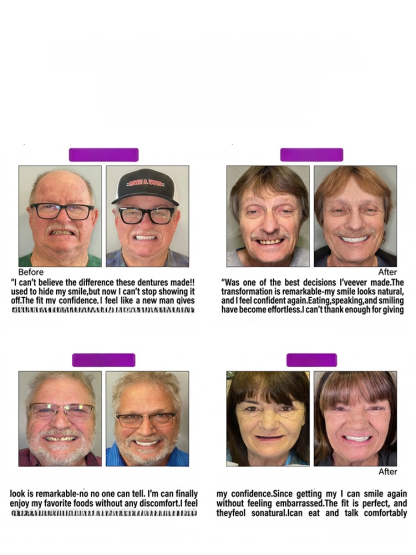 [Professional Certification] Regain Your Smile with Dentures. A natural and comfortable fit that makes you forget you're wearing them.