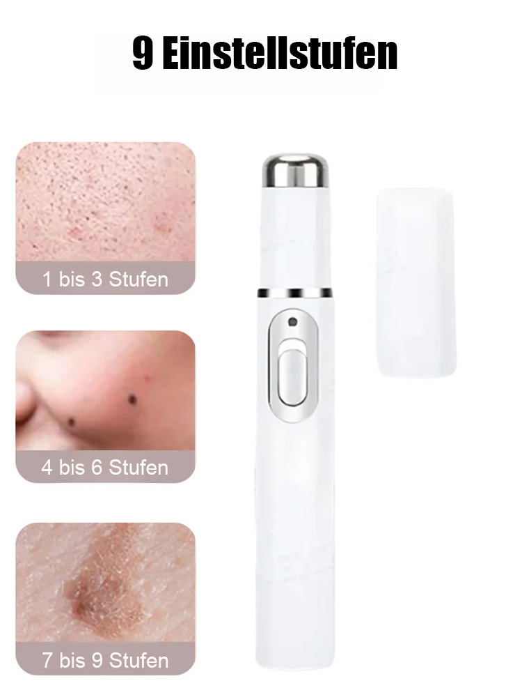 Laser schmerzfreier Warzenentferner-Stift