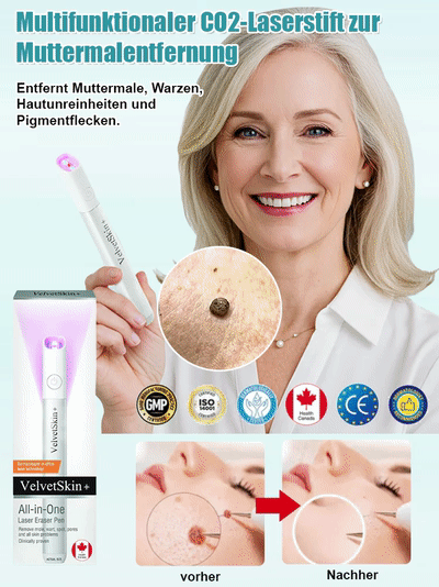 Sanfter Laser-Hautpflegestift zur Entfernung von Muttermalen und Warzen