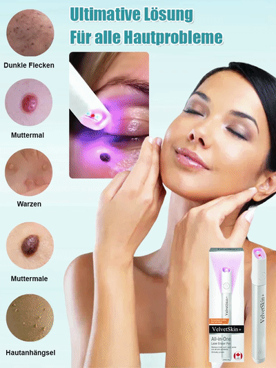Sanfter Laser-Hautpflegestift zur Entfernung von Muttermalen und Warzen