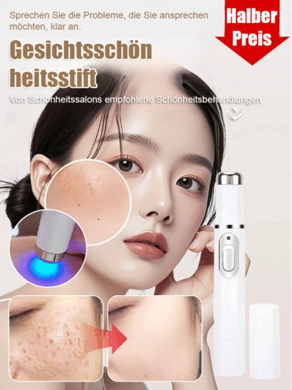 Laser schmerzfreier Warzenentferner-Stift