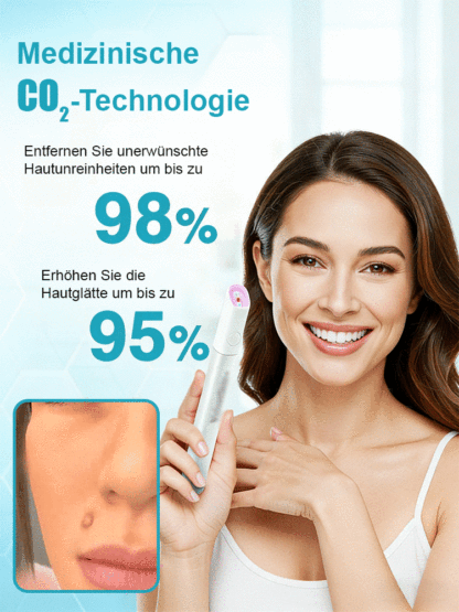 【Dauerhafte Entfernung】 Entfernung von Muttermalen, Warzen und Hautwucherungen, Laser-Muttermalentfe