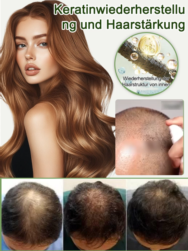 【Haarwuchs in 3 Tagen】Stärkendes und verdichtendes Anti-Haarausfall Spray
