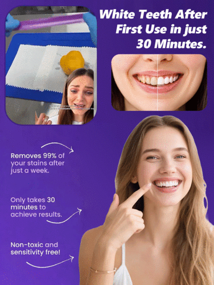 Purple Magic 💜 Watch Yellow Teeth Turn White Instantly with Color Correcting Strips! Whiter Teeth Without the Pain! 🦷 Testing Enamel-Safe Strips for Sensitive Teeth.