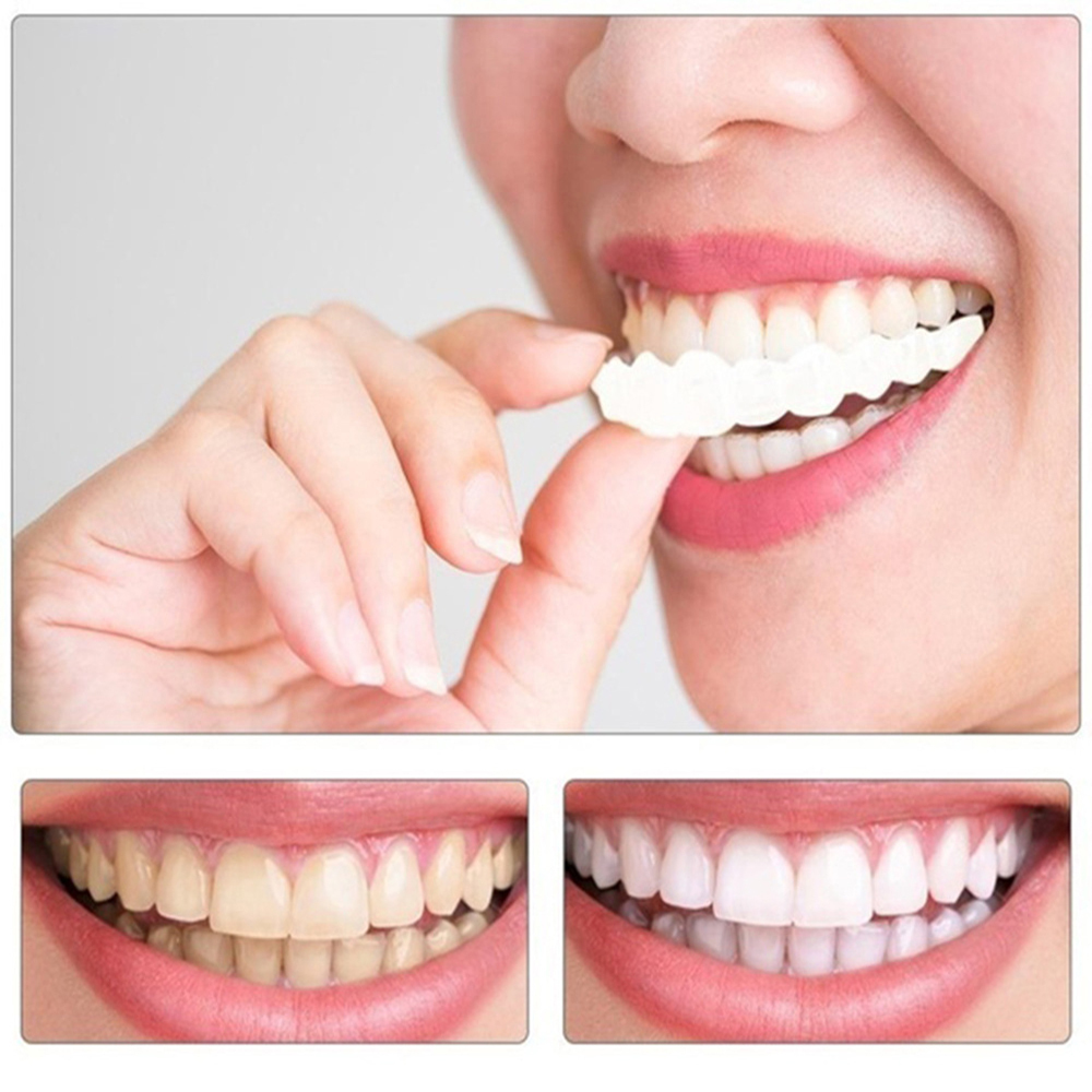 Whitening artificial teeth dentures
